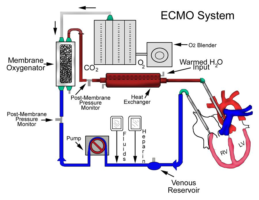 ecmo-extracorporeal