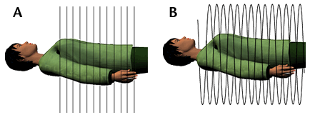 ::햇빛의료판례:: > 용어사전 > helical computed tomography, helical CT ; 나선형 컴퓨터단면촬영
